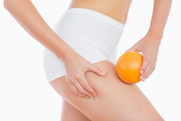 5 Myths about cellulite