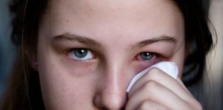Home Remedies For Conjunctivitis