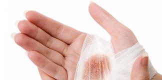 5 Natural remedies for cuts and scrapes