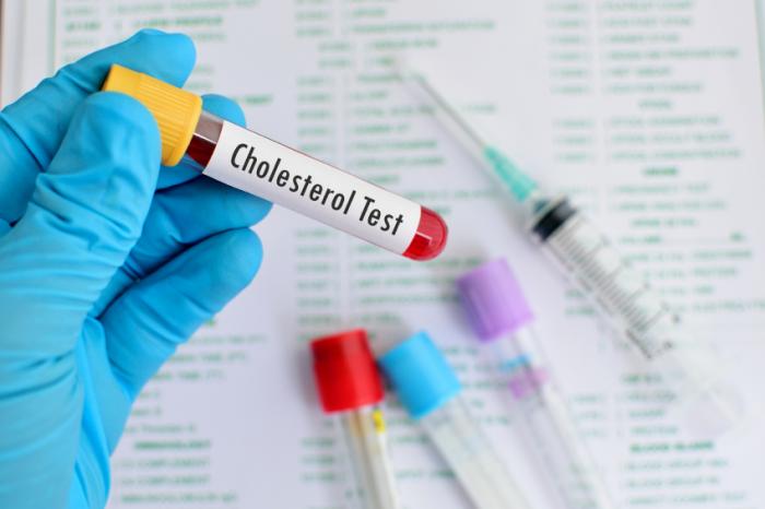 Cholesterol Test