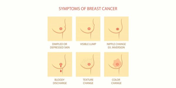 Be Aware About Breast Cancer