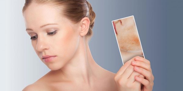 Six Signs of Sensitive Skin