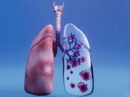 What Do Scientists Say about Immunotherapy Drugs to Treat Lung Cancer?