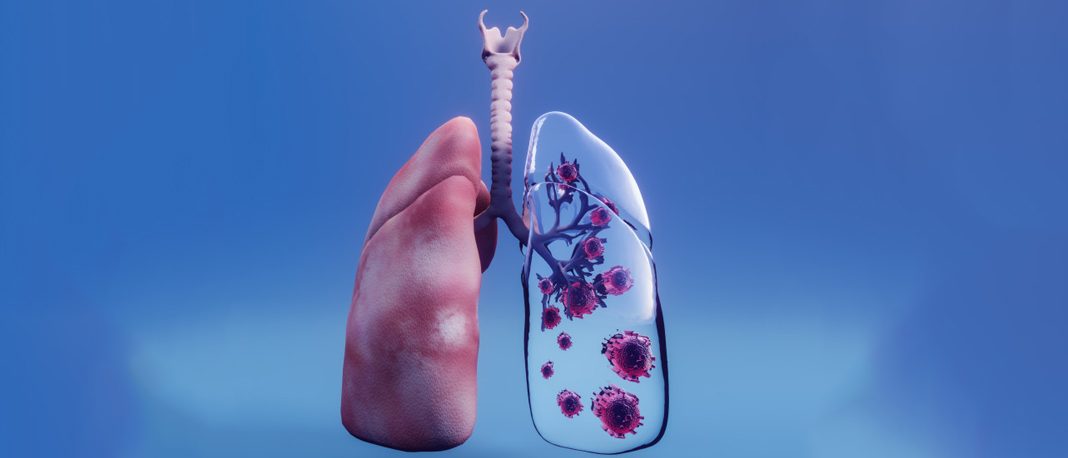 What Do Scientists Say about Immunotherapy Drugs to Treat Lung Cancer?