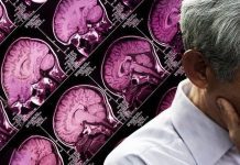 Can Age Related Memory Loss Be Reversed?