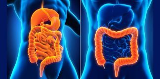 Crohn’s Disease Vs Ulcerative Colitis