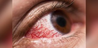 How To Spot Early Signs Of Diabetes Eye Problems?