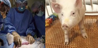 Pig Kidney Transplant To Human For The First Time