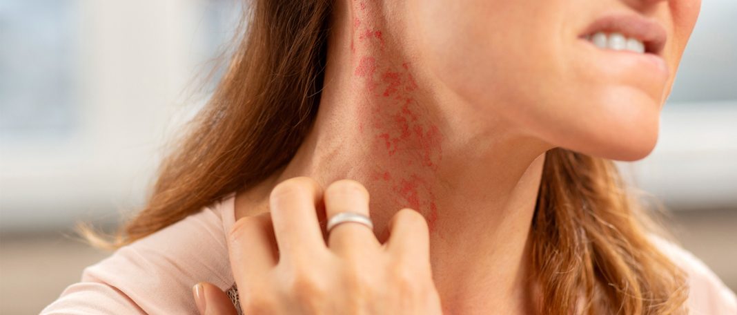 What Are The Common Causes Of Skin Allergies?