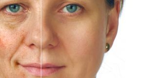 All About The Causes And Treatment Of Aging