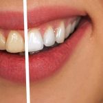 Simple Tricks For Keeping Your Smile White & Healthy