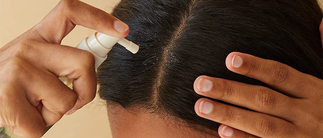 Scalp Sunscreen To Prevent Hair And Scalp Damage