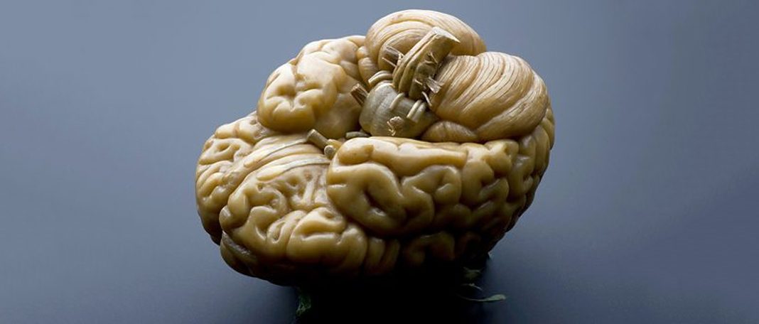 The Oldest Part Of The Brain