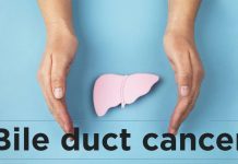 Everything You Must Know About Bile Duct Cancer