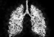 Myths And Facts Related To Lung Cancer