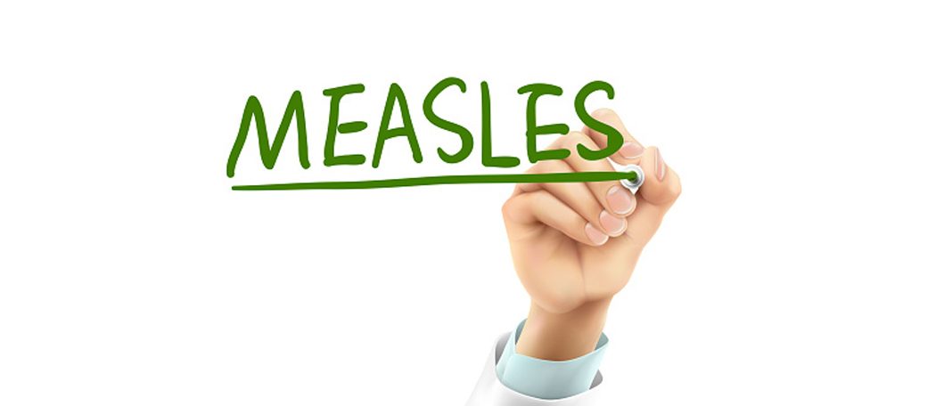 Everything You Need To Know About Measles