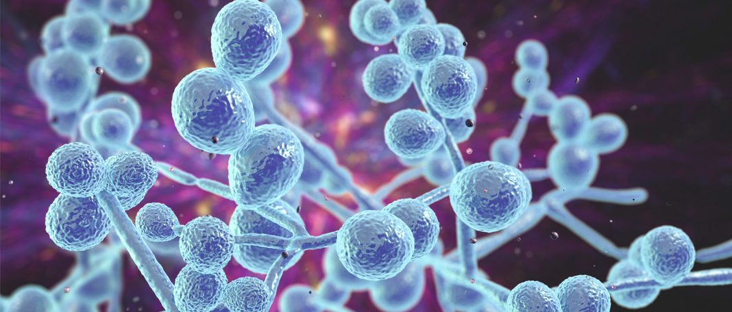 Everything you need to know about candida auris