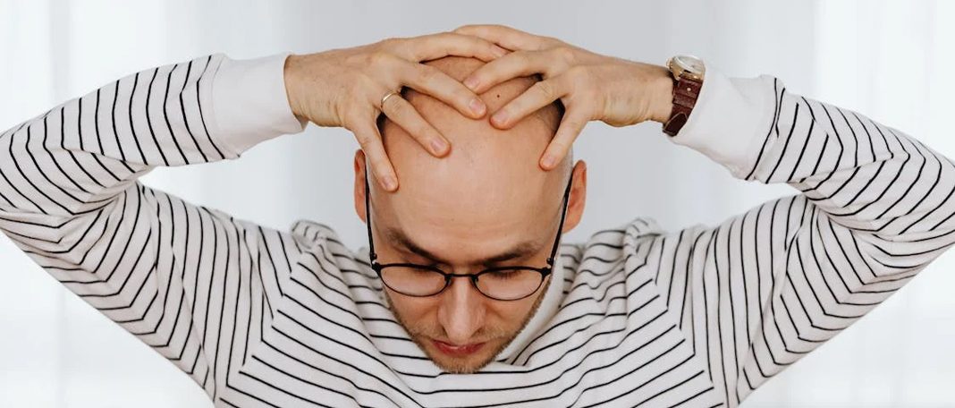 Stress and its impact on male hair loss