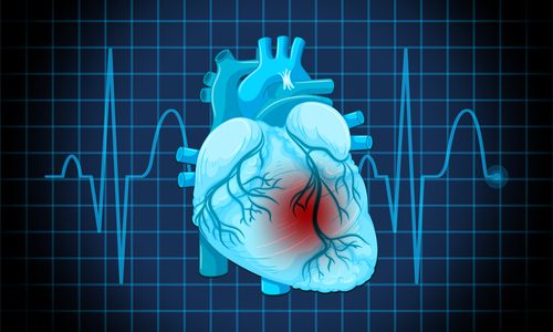 Decreased Risk of Heart Diseases